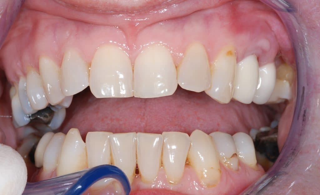 Cosmetic dentistry case 1 - after