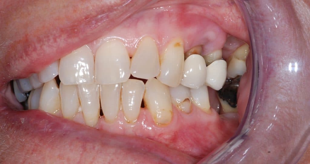 Cosmetic dentistry case 1 - before