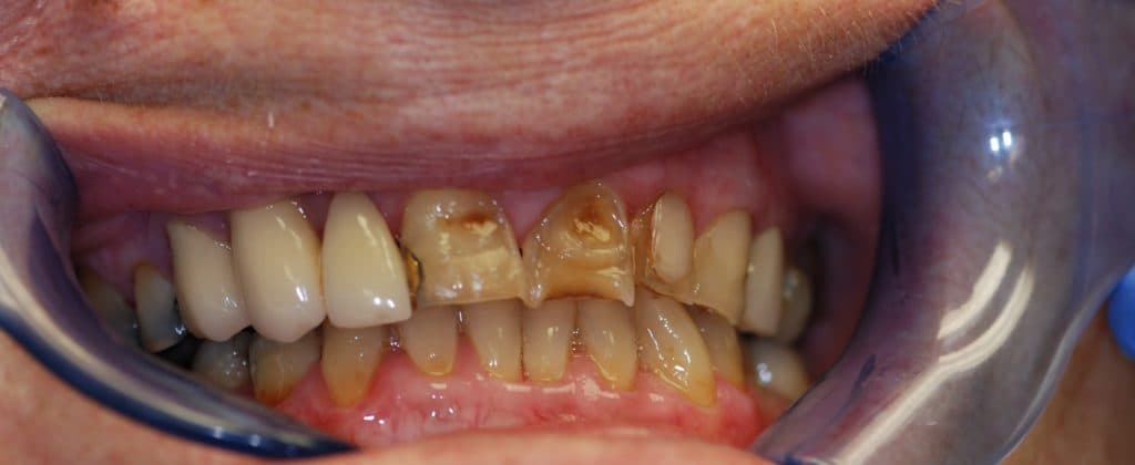 Cosmetic dentistry case 2 - before